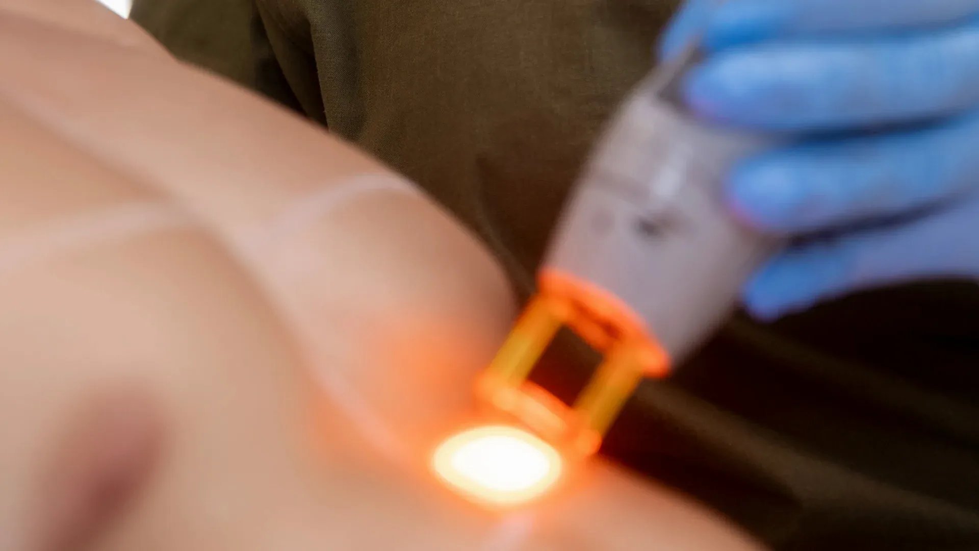 Men's laser hair removal at Nova Laser & Beauty Clinic in Yeroskipou - discreet appointment-only treatment room